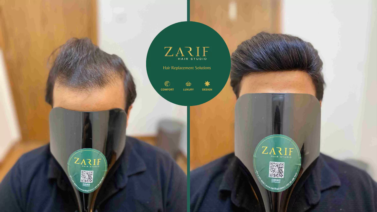 hair fixing zarif