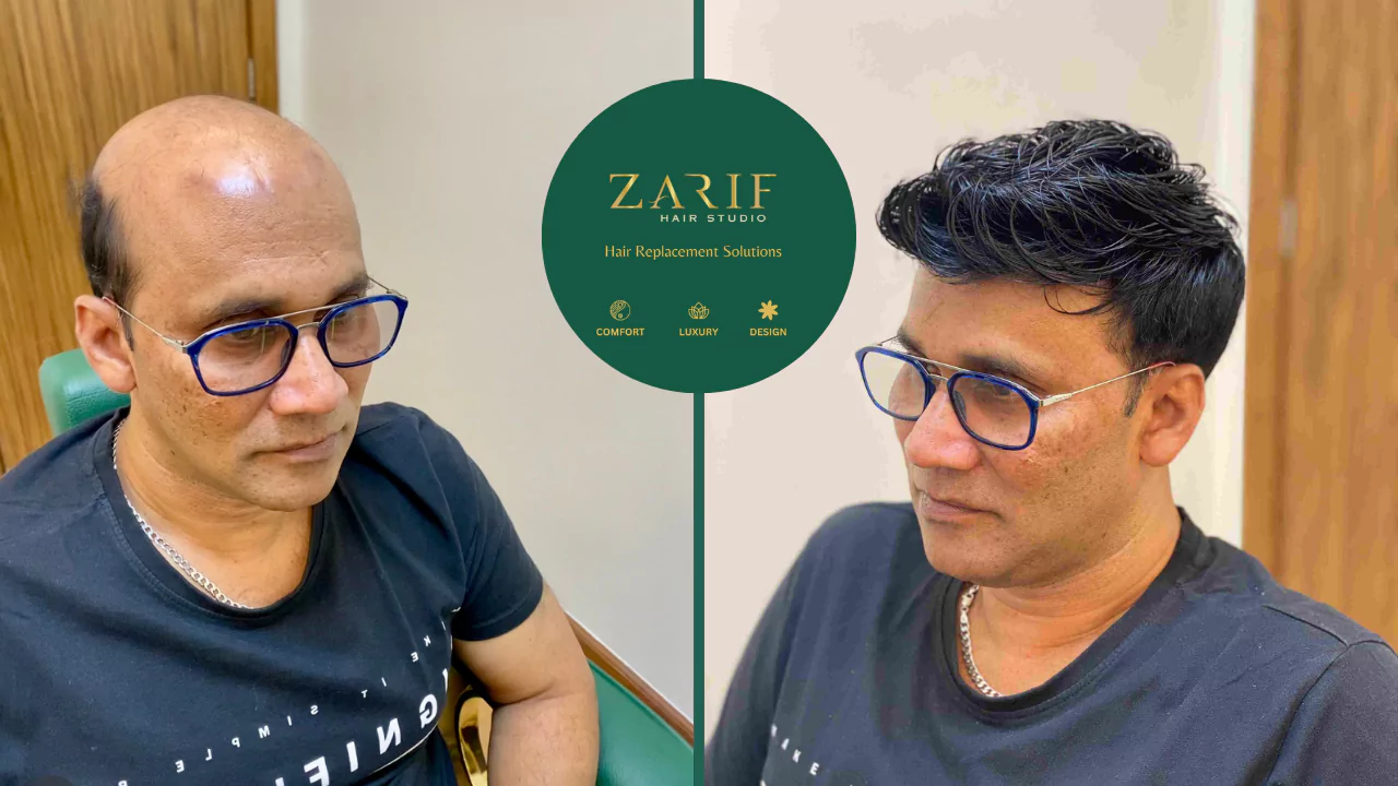 hair wig fixing Dubai